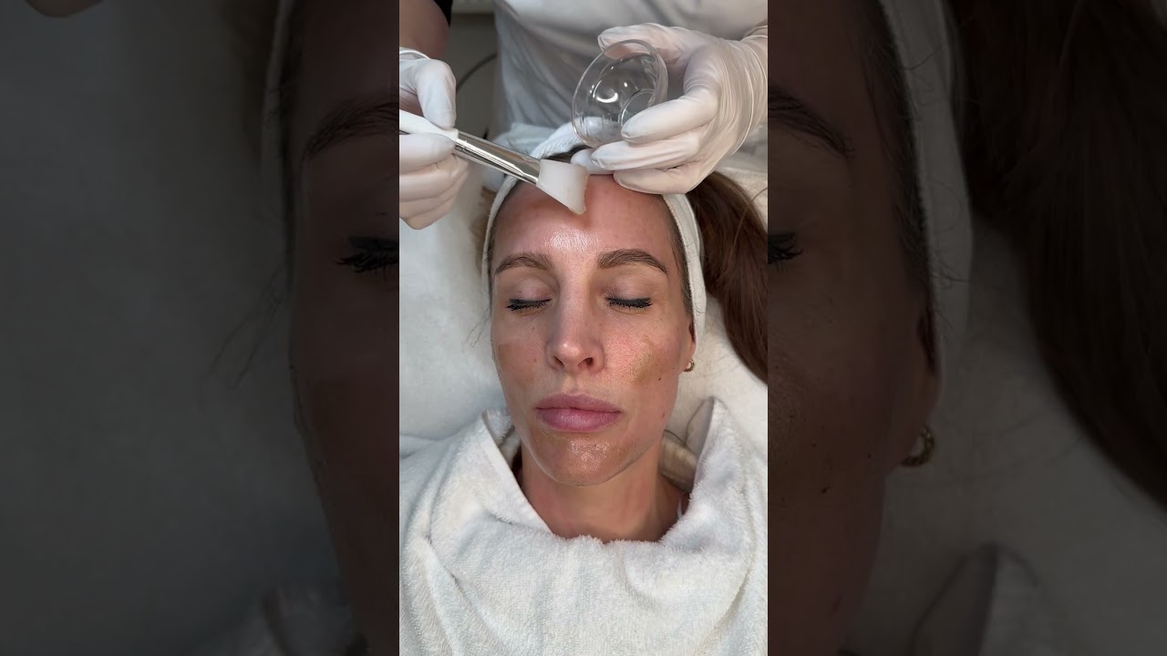SkinRePeel: peeling voor het gezicht bij pigment & onzuiverheden