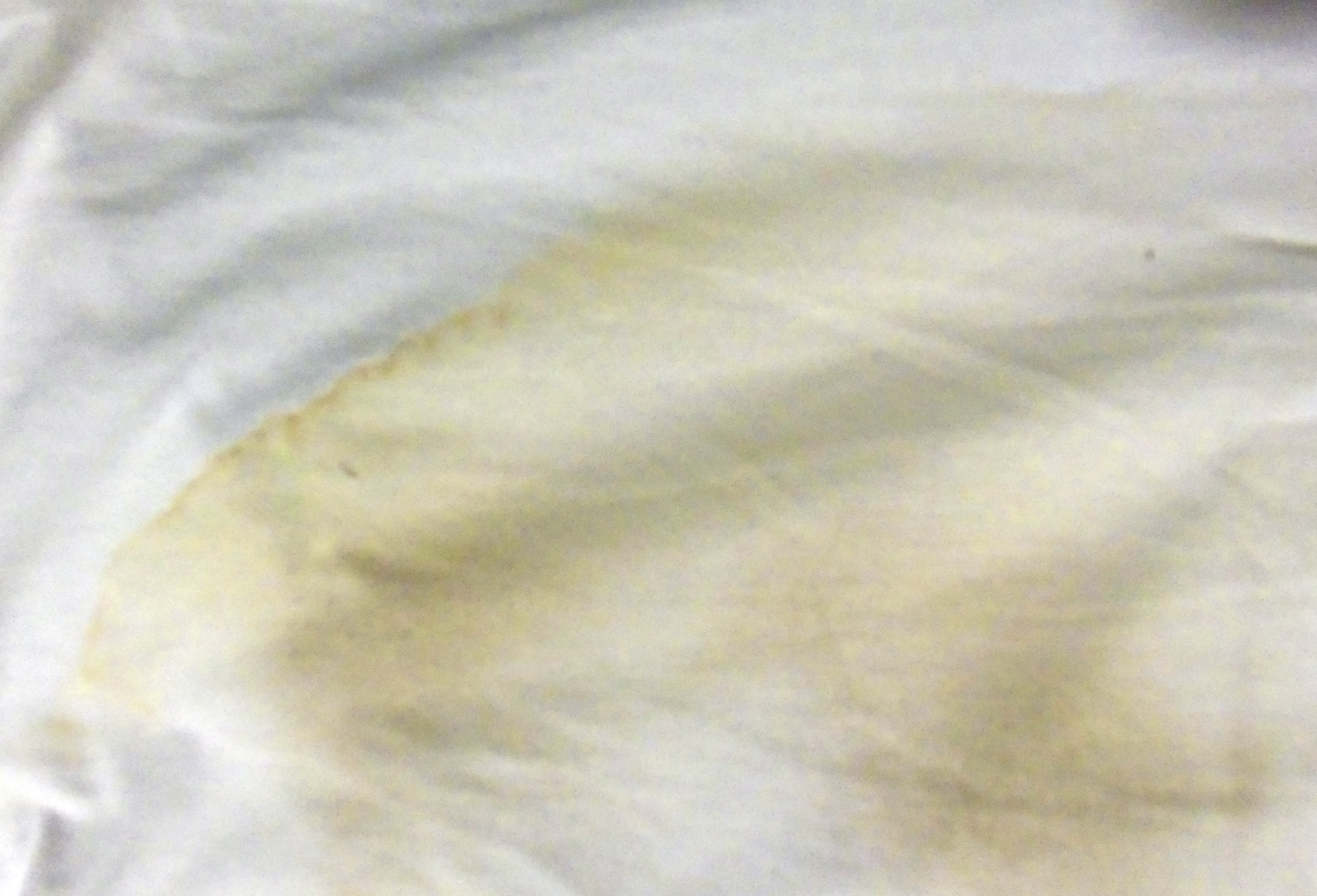 risico mixer voordeel Zo verwijder je gele zonnebrandvlekken uit je witte kleding! - Damespraatjes