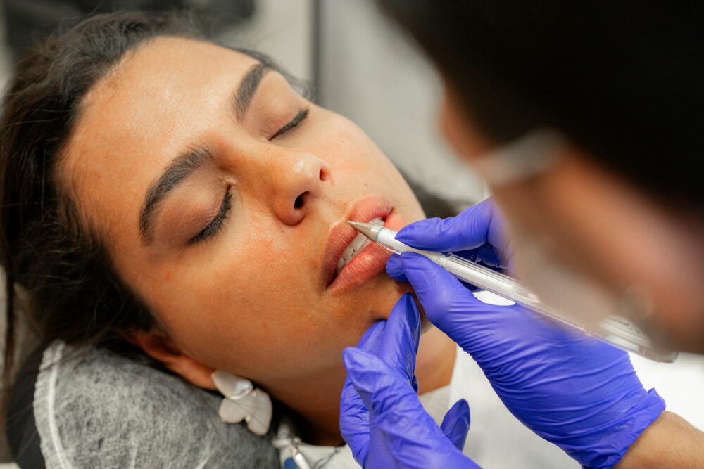 Fillers: wat je ervoor moet weten voordat je een afspraak maakt
